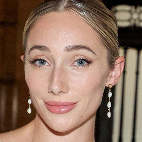 أورورا كالبو